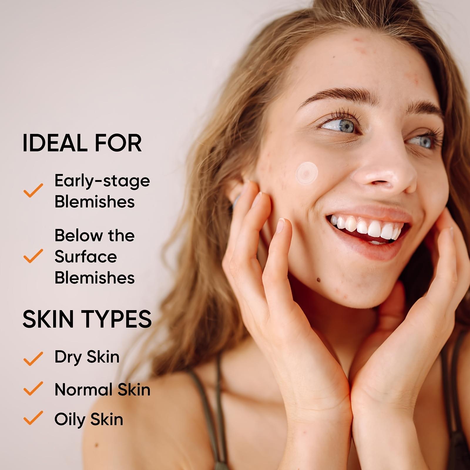 Plester Jerawat Hidrogel Ukura - Xl Skincare ulasan dan harga