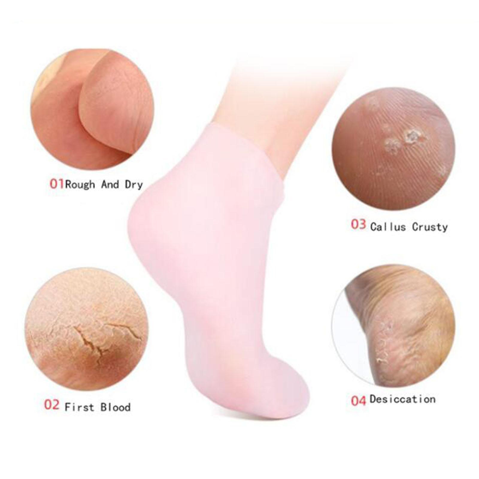 Kaus Kaki Gel Silikon Lembut P - Xl Skincare ulasan dan harga